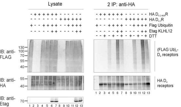 Fig 4. Treatment with a highly reducing agent decreases ubiquitination of D 4.2 R WT and D 4.2 4KR R mutant