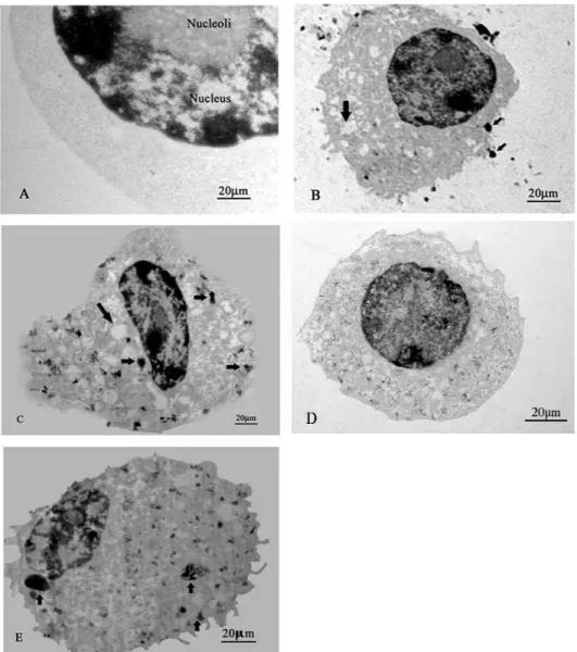 Fig. 2:  The  role  of  actin-filament  polymerization  in  phagocytosis  of  HA  particles  and  latex  bead  by  RAW264.7  cells