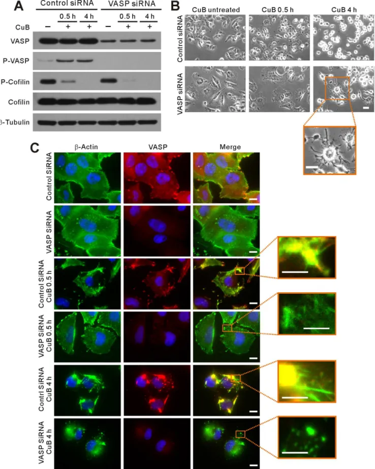 Figure 2. VASP knockdown mitigated CuB (0.1 mM)-induced actin aggregation, cofilin-actin rod formation and cell deformation