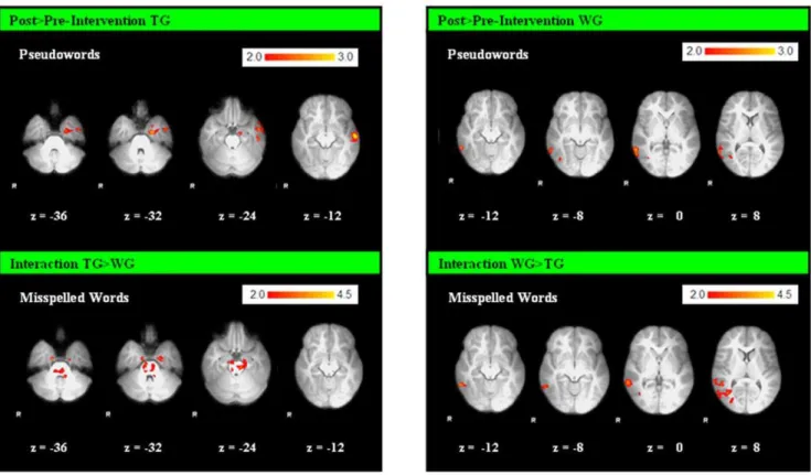 Table 3. Correlation: Increase of activation 6 less behavioral improvement in the TG.