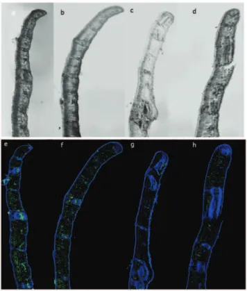 Figure 7. Immunodetection of AcH3 in sections of cork oak in transversal axis using a confocal microscope