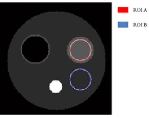 Figure 6: ROIs used to measure the CNR 