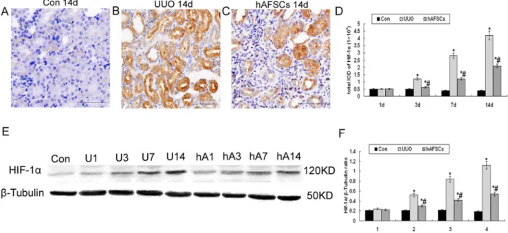Figure 5. Immunohistochemical staining and Western blot analysis of HIF-1a expression