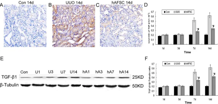 Figure 6. Immunohistochemical staining and Western blot analysis of TGF-b1 expression