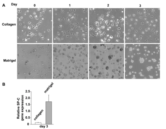 Figure 1. In vitro culture of adult human alveolar epithelial cells. (A) Human lung AT2 cell morphology changes more when cultured on rat- rat-tail collagen-coated dishes than on Matrigel-coated dishes