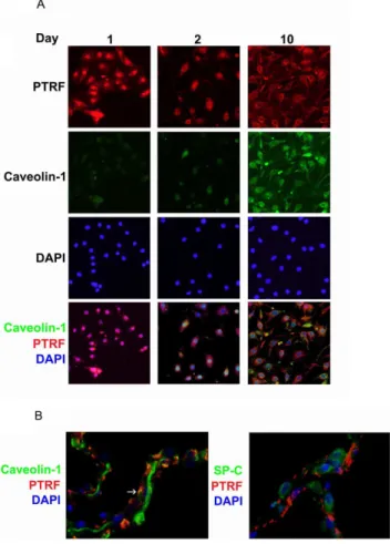 Figure 5. Sub-cellular localization of PTRF/CAVIN-1 changes from nuclear to cytoplasmic in transitioning hAT2 cells