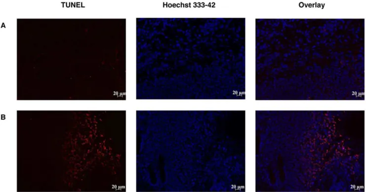 Figure 5. Effect of PTX-loaded micelles 24 h pre-treatment on TLT tumor apoptosis assessed by TUNEL assay