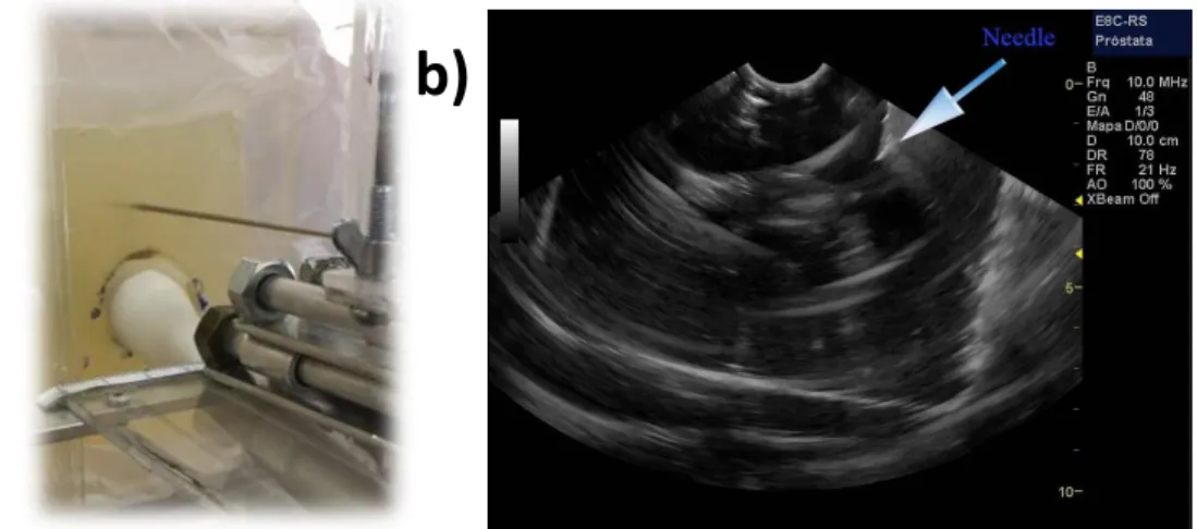 Figure 11: Image of the needle during the application procedures. a) Image observed in the prostate sim- sim-ulator