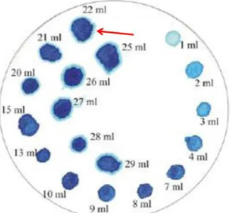 Figure 2: Appearance of the drop in the adsorption process of methylene blue 