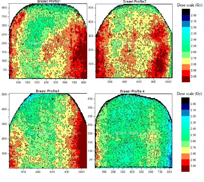 Figure 6: Spatial dose maps generated in the internal left-breast for hypo fractioned 4-filed IMRT  protocol, XY-scales in mm