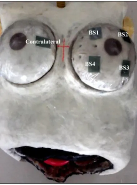 Figure 1: Position of radiocromic films on the skin of the thorax phantom 