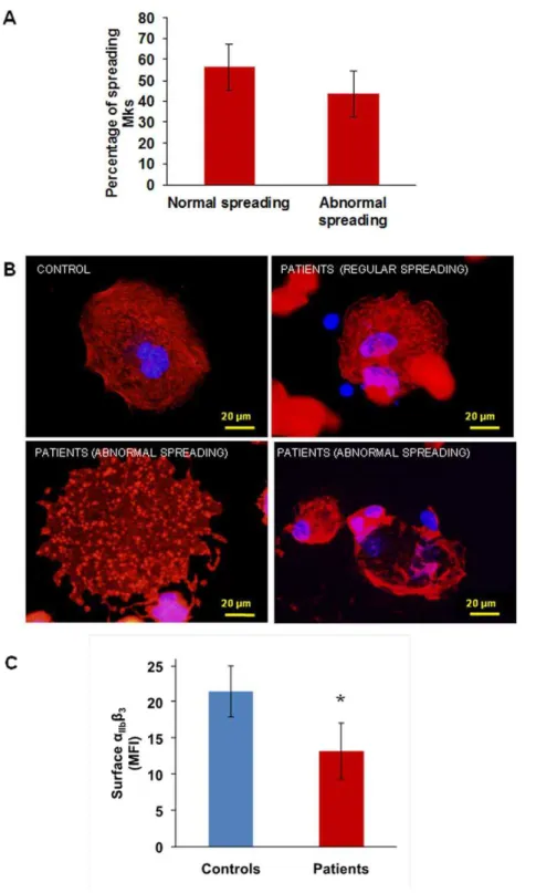 Figure 2. Megakaryocyte spreading on fibrinogen and a IIb b 3 expression. (A) and (B) When plated on fibrinogen two populations of megakaryocytes are visible: half of the population spread regularly, while half showed abnormal spreading, with nuclei displa