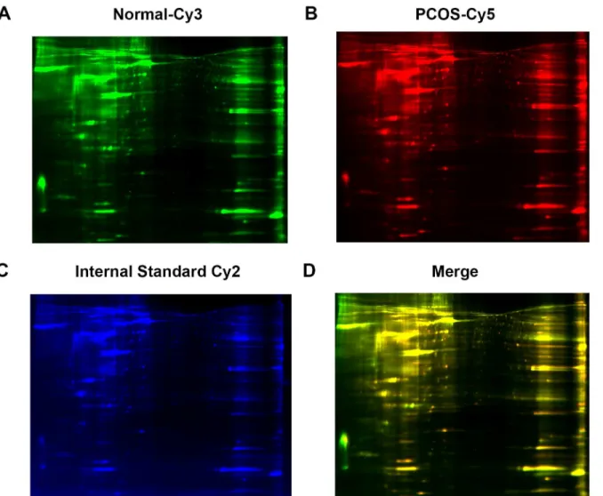 Fig 2. Protein analysis by 2D-DIGE analysis. Ovarian tissues from patients with PCOS and healthy controls were analyzed for differential protein