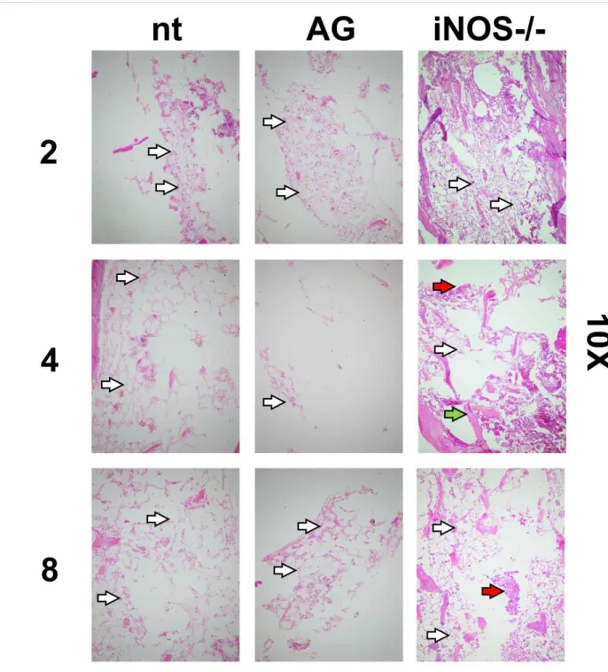 Figure 6: Histological images of bone marrow preparations (HE stain) from non-treated,  treated (aminoguanidine) and iNOS -/-  8Gy irradiated mice