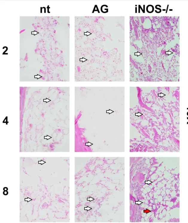 Figure 7: Histological images of bone marrow preparations (HE stain) from non-treated,  treated (aminoguanidine) and iNOS -/-  8Gy irradiated mice