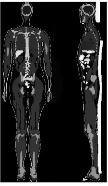 Figure 2: Coronal and sagittal views of Golem phantom.  