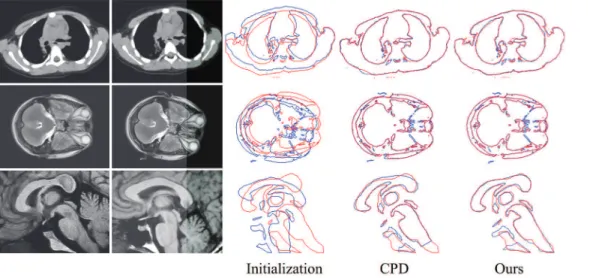 Fig 10. Registration examples on the real data. The top row is a pair of thorax CT images, the middle row is a pair of transverse plane from brain MRI, and the bottom row is a pair of sagittal plane from brain MRI