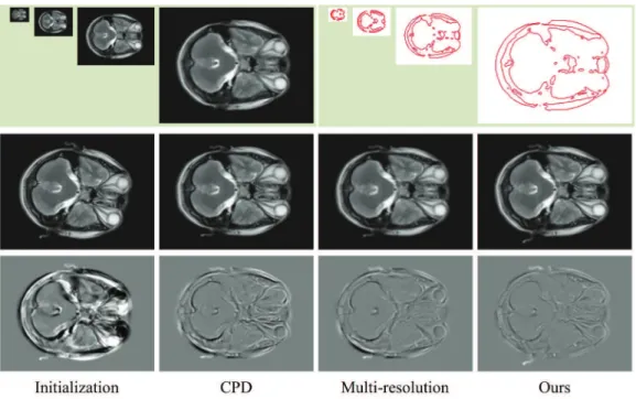 Table 2. Registration error for the sagittal plane brain MRI data.