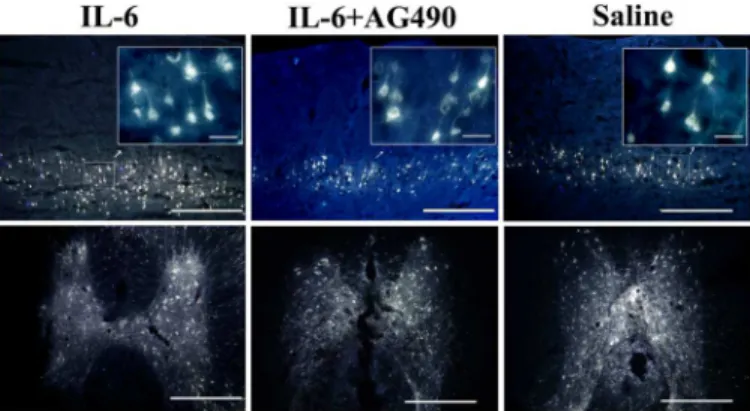 Fig 4. Expression of gp-130 in the sensorimotor cortex and the spinal cord. Pyramidal cells were double labeled with FG and βIII- tubulin