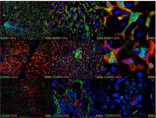 Figure S1 Human engraftment in the livers of mice with indication of graft versus host disease