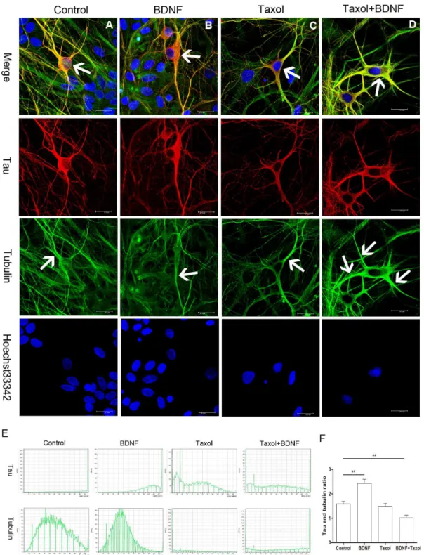 Figure 6. Tau protein distribution after BDNF, taxol and taxol + BDNF treatment. (A) Tau protein distribution in control E18 hippocampal neurons