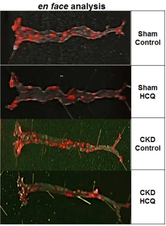 Fig 3. En face analysis of dissected entire aortic specimens in all groups of mice at the end of 16 weeks of therapy