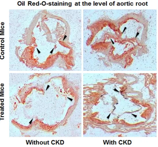 Fig 5. Isolated aortic bulb analysis with Oil Red O staining in CKD groups. Representative images of Oil Red O staining for lipid deposits in ascending aortas of all groups of mice