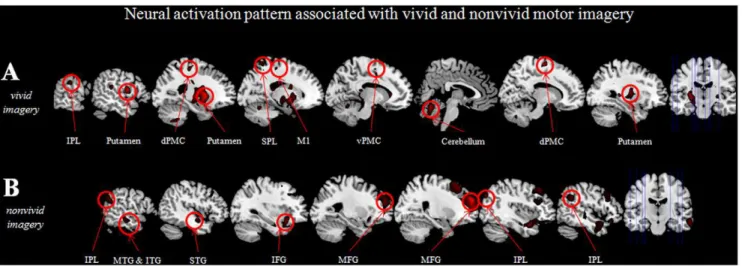 Figure 2. Brain areas showing greater activation as a function of vivid (A) and nonvivid (B) motor imagery based on calculating a parametric modulation.