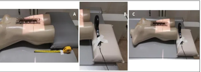 Figura 1 – A) Identificação da distância da posição das mãos do profissional em relação ao  raio central do exame; B) Posição da câmara de ionização no local identificado na imagem 