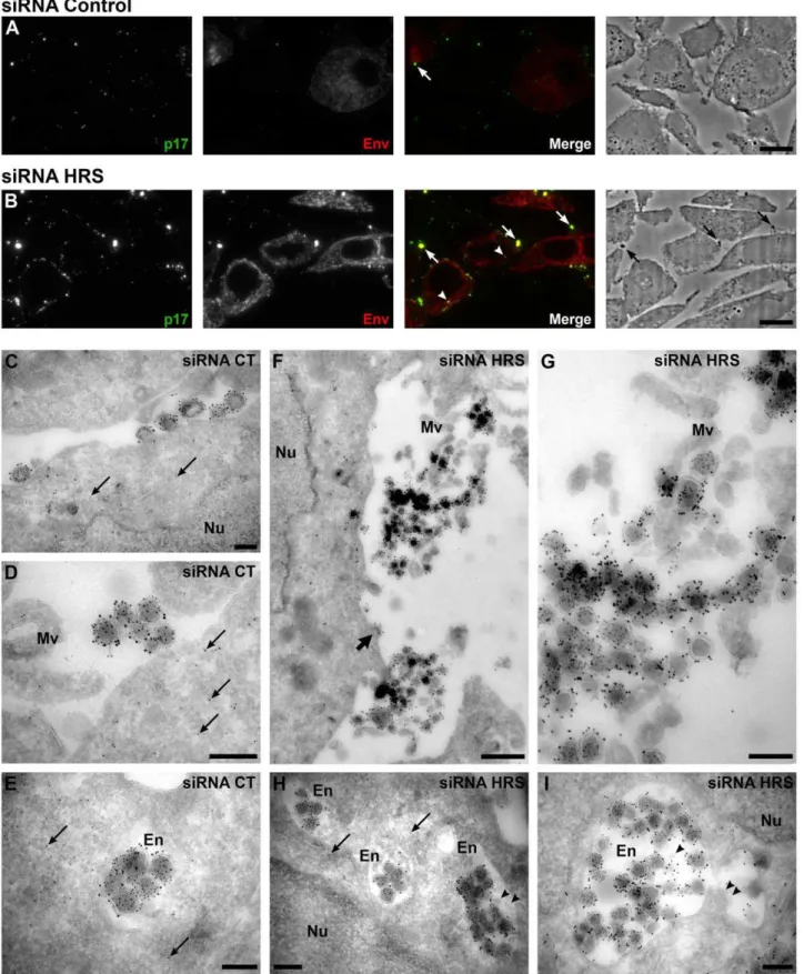 Figure 3. Silencing of HRS leads to accumulation of HIV-1 particles in at the cell surface and in endosomes