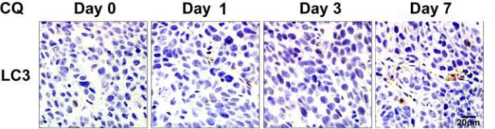 Fig 5. Delayed effects of autophagy inhibition by CQ in xenograft tumors. Tumors treated with CQ (60 mg/kg/day) were collected after treatment for 1, 3 and 7 days and sectioned for LC3 immunohistochemistry.