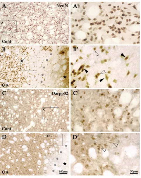 Fig. 6A9 and B9). Unlike the three types of GABAergic interneurons, the ChAT + interneurons remained morphologically stable without varicosity formation (Fig