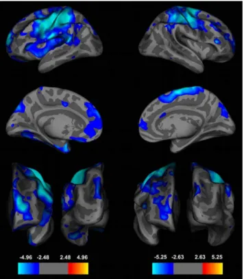 Figure 2. Whole-Brain Analyses of the Local Gyrification Index (lGI) during Adolescence
