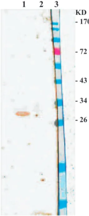 Fig 2: Agarose gel electrophoresis analysis of recom- recom-binant pET-28a-hpaA. Lane1:1Kb DNA marker, Lane 2: 