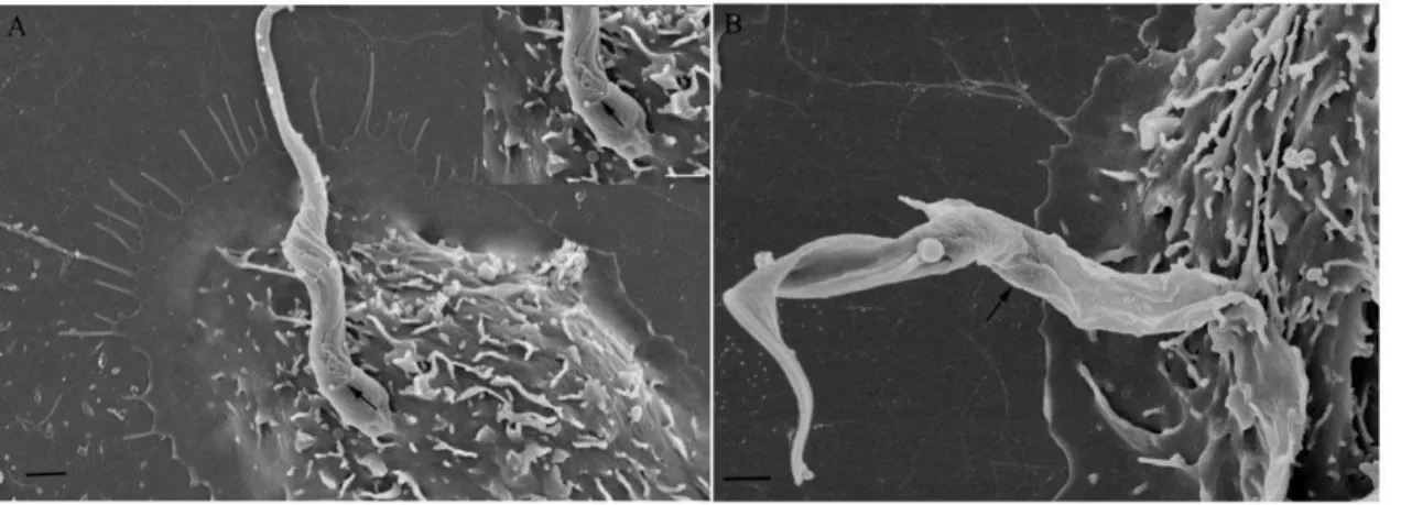 Figure 7. Field emission electron microscopy observations of the interaction process between peritoneal dynasore treated macrophages and T