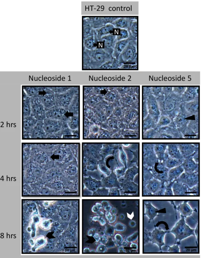 Fig 6. Nucleoside-induced morphological changes in HT-29 cells include rapid perinuclear vacuole formation (nucleoside 1 and 2) and a loss of cellular adherence (nucleoside 5)