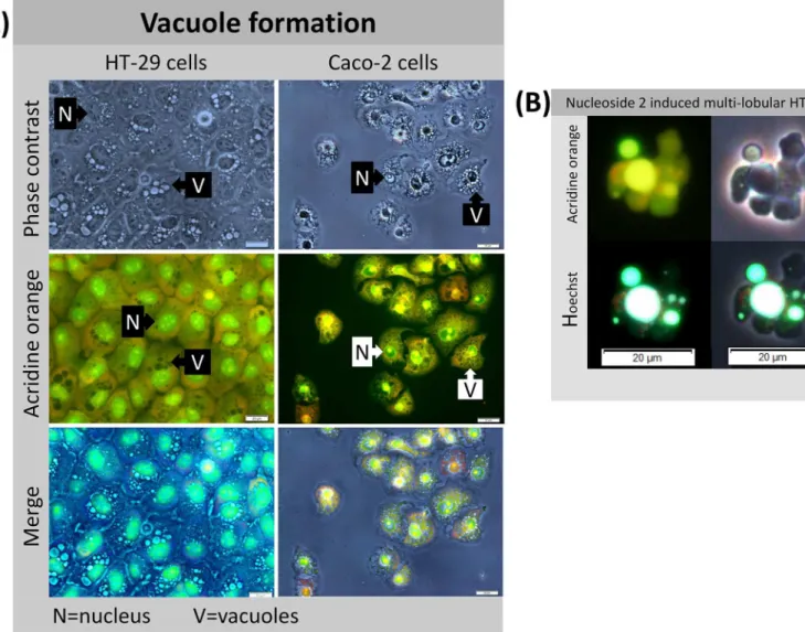 Fig 7. Nucleoside-induced morphological changes in Caco-2 cells include rapid perinuclear vacuole formation (nucleoside 1 and 2) and a loss of cellular adherence (nucleoside 5)