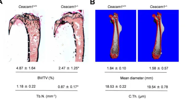 Fig. 3. Analysis of long bones derived from 6-month-old mice lacking Ceacam1 . (A) Von Kossa staining of non-decalcified tibia sections from controls (Ceacam1 + / + ) and Ceacam1-deficient mice (Ceacam1 -/- ) and histomorphometric quantification of the tra