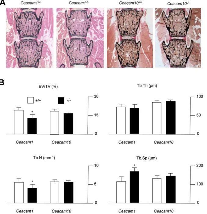 Fig. 2. Decreased trabecular bone mass in 6-month-old mice lacking Ceacam1 . (A) Von Kossa staining of non-decalcified spine sections from controls (Ceacam1 +/+ , Ceacam10 +/+ ) and Ceacam1- or Ceacam10-deficient mice (Ceacam1 -/- , Ceacam10 -/- )
