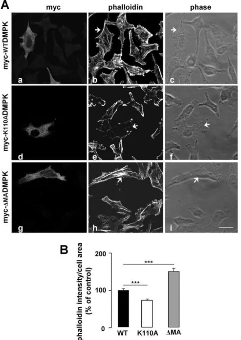 Figure 4. Overexpression of DMPK mutants alters stress fiber formation in HeLa cells. (A) Stress fiber formation was analyzed by phalloidin labeling