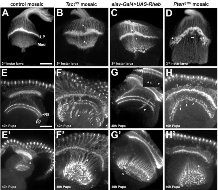 Figure 5. Photoreceptor axon projection defects associated with increased Tor signaling
