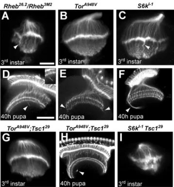 Figure 7. Axon guidance defects in Tsc1 mosaics are not suppressed by blocking growth
