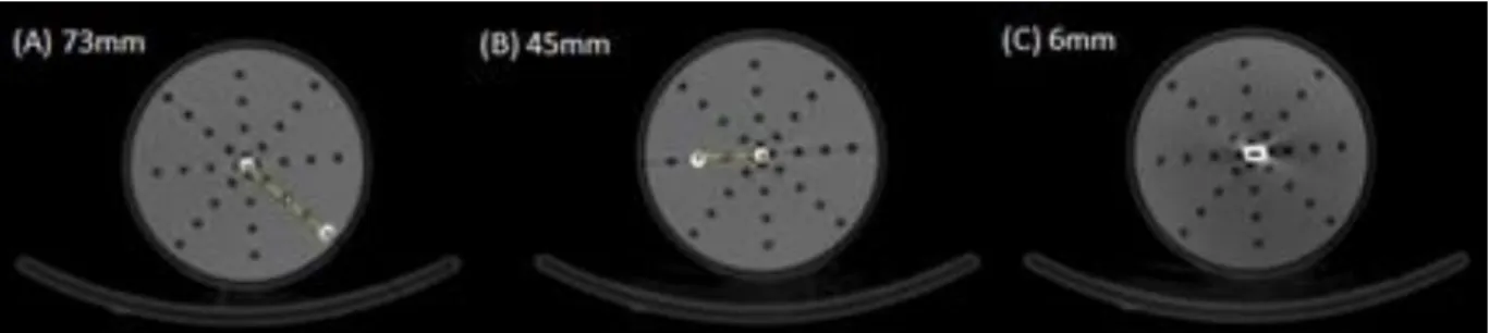 Figure 1: References source positioned at (A) 73 mm, (B) 45 mm and (C) 6 mm from the center of  the cylindrical phantom filled with water.