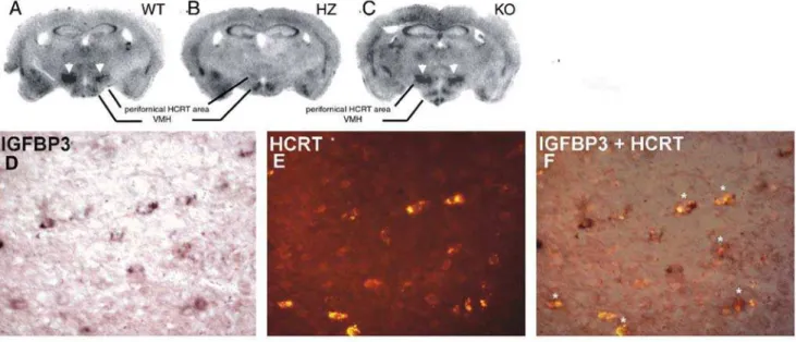 Figure 1. IGFBP3 signals in wild type, ataxin-3 hemizygous, and hypocretin KO mice. The upper panel shows IGFBP3 ISH staining in wild type (A: WT), ataxin-3 hemizygous (B:HZ) and HCRT knockout (C: KO) mice
