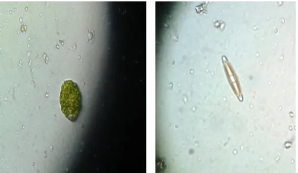 Figura 3: Organismo do filo Mastigophora do Figura 4: Organismo do filo Heterokonta do gênero  Euglena sp