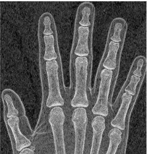Fig. 9. The entropy of an image of Fig. 8. 