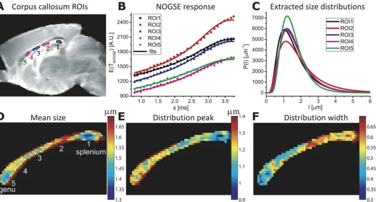 Fig 4. Mapping histological size distributions in a mouse corpus callosum. (A) Definitions of the various ROIs placed in different anatomical regions, superimposed on a reference MRI image