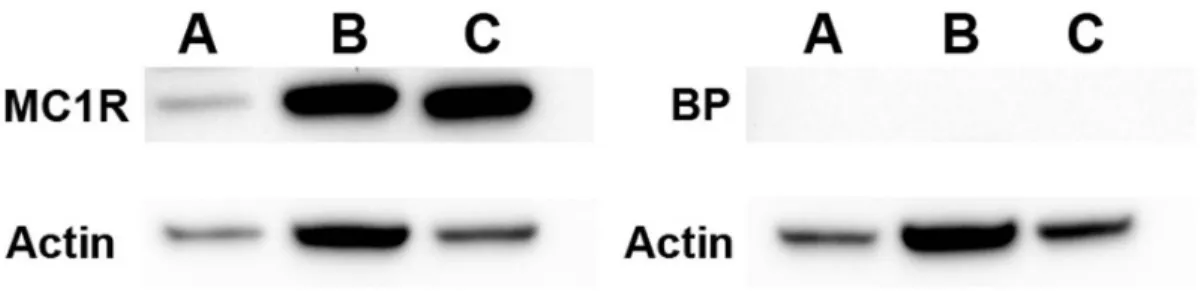 Figure 5. MC1R protein expression. Western blotting was performed in order to detect MC1R protein expression in mouse and human tissue.