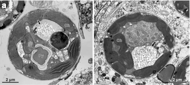 Figure 5. Transmission electron micrographs of Symbiodinium cells in the giant clam Tridacna crocea 