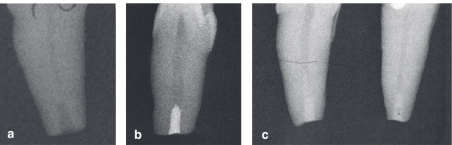 Fig. 2 View after apical resection a. After preparation of the root canal with straight fissure bur b